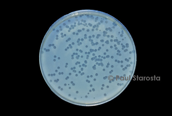 Escherichia coli B (colibacillle) - culture en présence d'un bactériophage (T4)