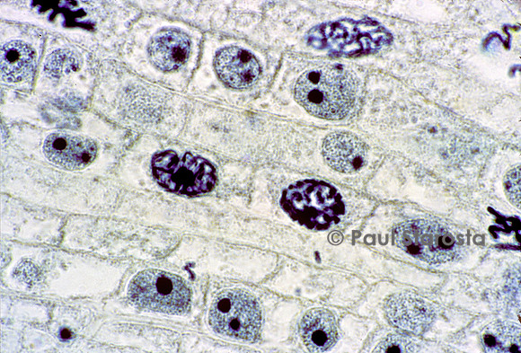 Cellules de racine d'oignon en mitose vues au microscope optique