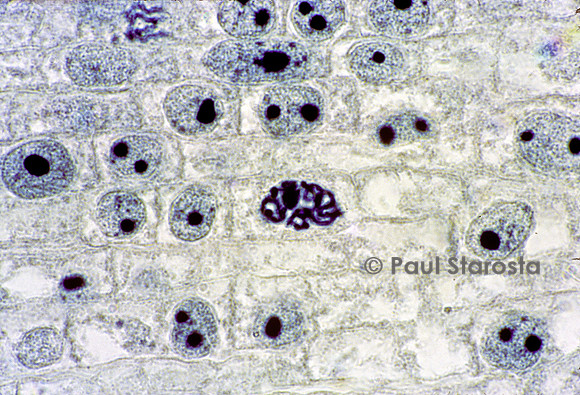 Cellules de racine d'oignon en mitose vues au microscope optique