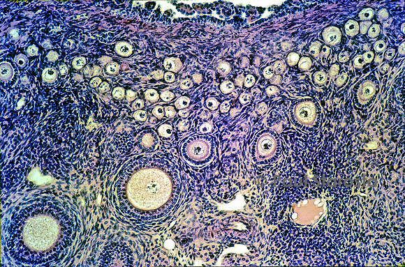 Follicules ovarien dans un ovaire de lapine (Oryctolagus cuniculus)