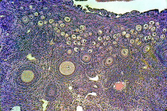 Follicules ovarien dans un ovaire de lapine (Oryctolagus cuniculus)