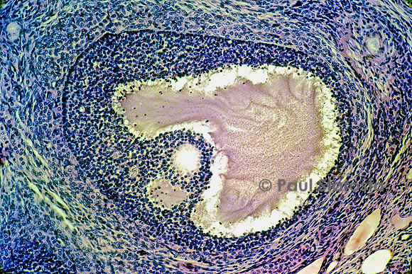 Follicules ovarien dans un ovaire de lapine (Oryctolagus cuniculus)