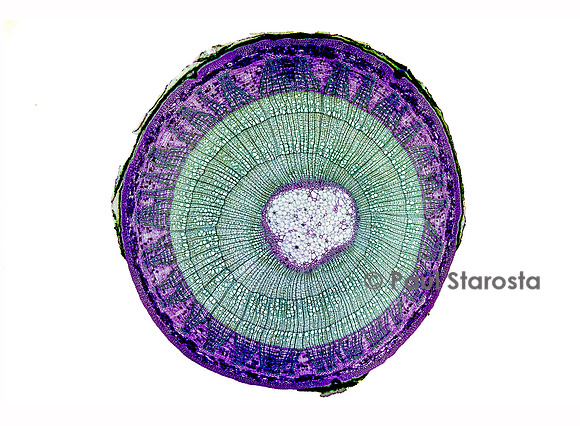 Coupe transversale de tige de tilleul (Tilia sp.)