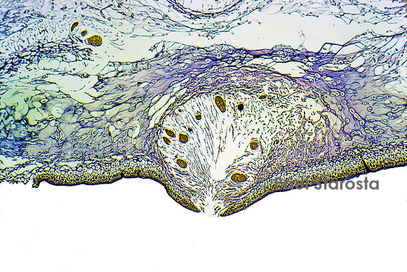Conceptacle femelle de fucus vésiculeux (Fucus vesiculosus)