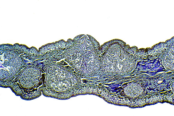 Conceptacle mâle de fucus vésiculeux (Fucus vesiculosus)