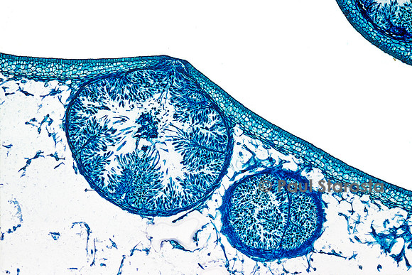 Conceptacle mâle de fucus vésiculeux (Fucus vesiculosus)