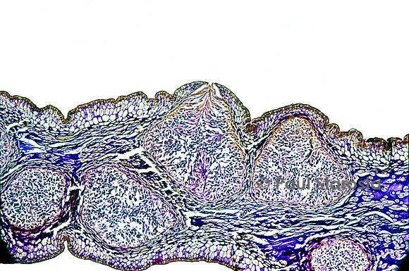 Conceptacle mâle de fucus vésiculeux (Fucus vesiculosus)
