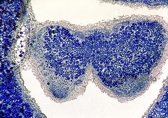 Coupe transversale de nodosité de racine de luzerne (Medicago sativa)