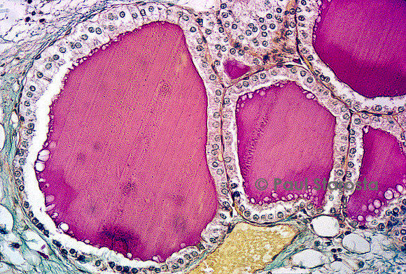 Follicules thyroïdiens de rat