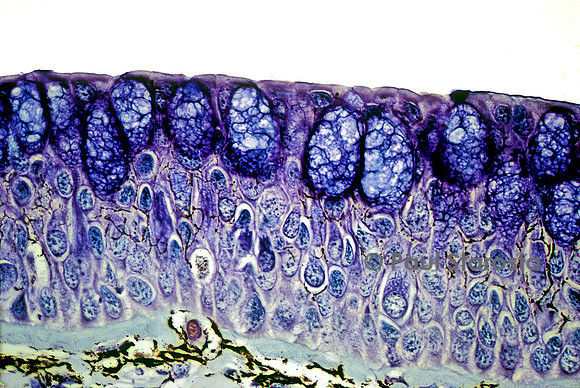 Cellules épithéliales - peau de protoptère (Protopterus sp.)
