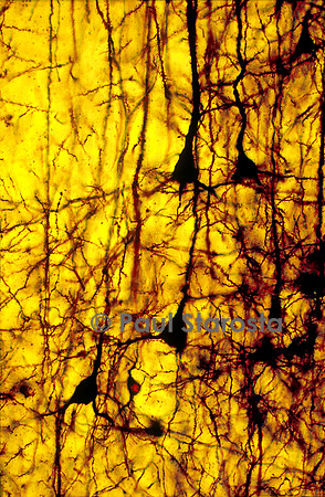 Cortex cérébral de chat