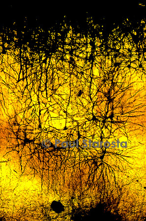 Cortex cérébral humain