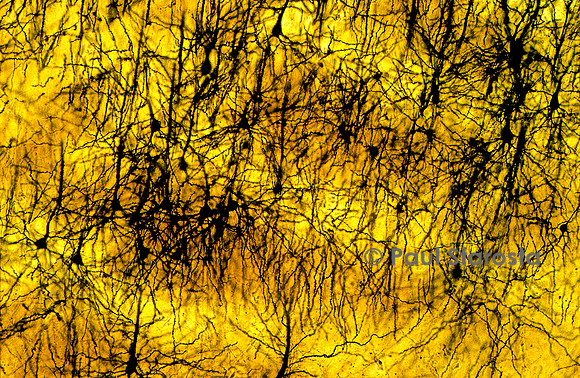 Cortex cérébral humain