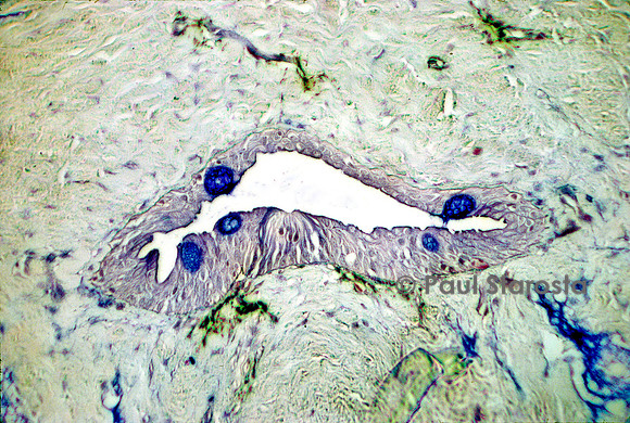 Neuromaste dans le canal céphalique d'un protoptère