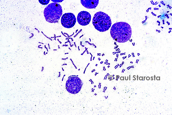 Chromosomes humains