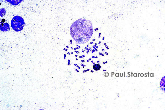 Chromosomes humains