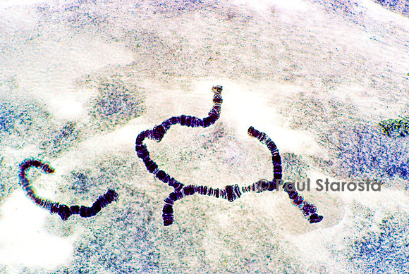 Chromosome géant - glande salivaire de chironome (Chironomus plumosus)