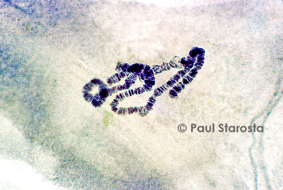 Chromosome géant - glande salivaire de chironome (Chironomus plumosus)