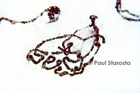 Chromosome géant de glande salivaire - drosophile (Drosophila pseudoobscura)