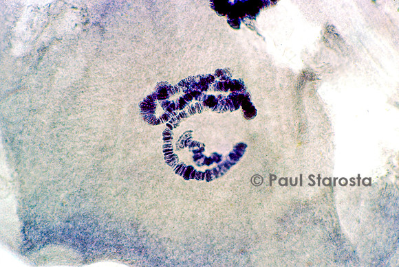Chromosome géant - glande salivaire de chironome (Chironomus plumosus)