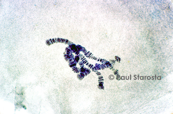 Chromosome géant - glande salivaire de chironome (Chironomus plumosus)