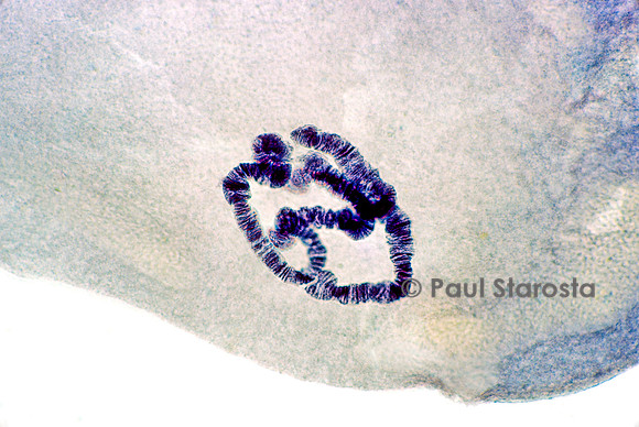 Chromosome géant - glande salivaire de chironome (Chironomus plumosus)