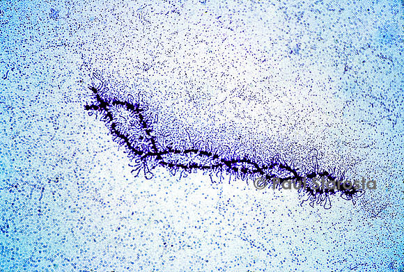 Chromosome en écouvillon - ovocyte de pleurodèle (Pleurodeles waltl)