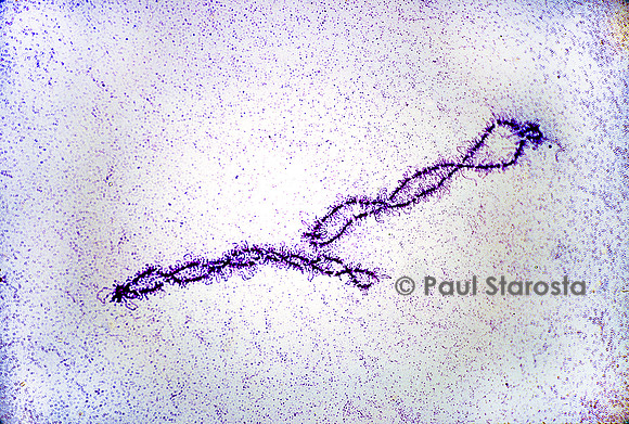 Chromosome en écouvillon - ovocyte de pleurodèle (Pleurodeles waltl)