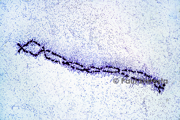 Chromosome en écouvillon - ovocyte de pleurodèle (Pleurodeles waltl)