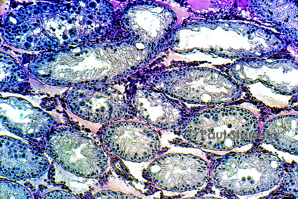 Testicule cryptorchide de rat