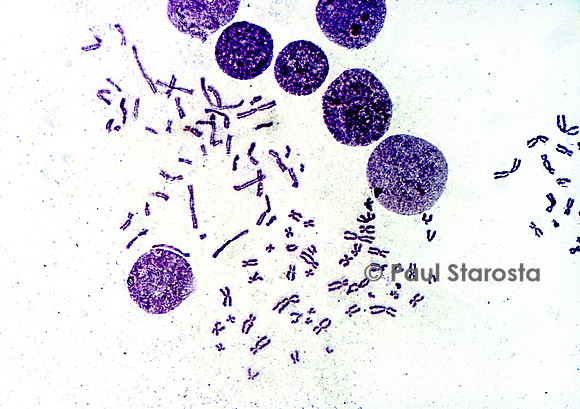 Chromosomes humains