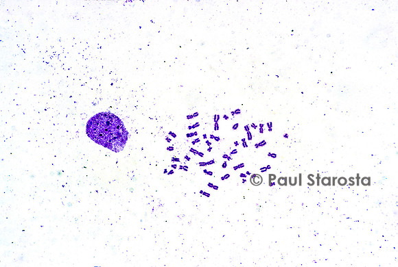 Chromosomes humains