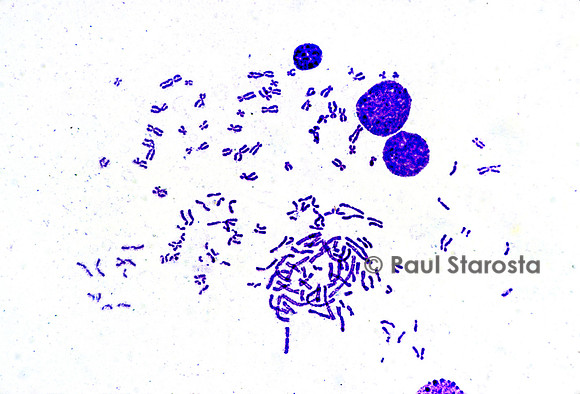 Chromosomes humains