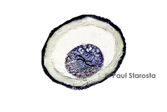 Ovocyte d'ascaris (Ascaris lumbricoides)
