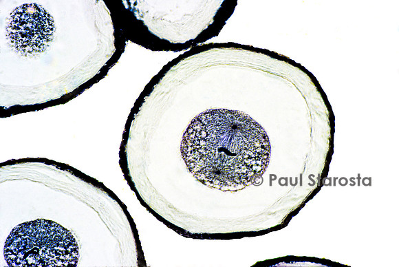 Ovocyte d'ascaris (Ascaris lumbricoides)