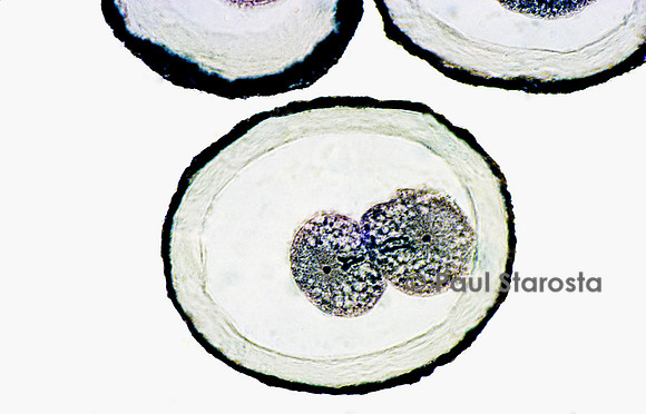 Ovocyte d'ascaris (Ascaris lumbricoides)