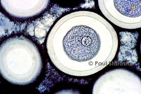 Ovocyte d'ascaris (Ascaris lumbricoides)