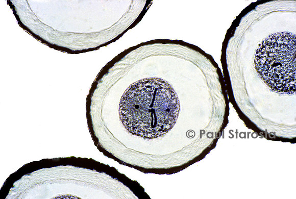 Ovocyte d'ascaris (Ascaris lumbricoides)