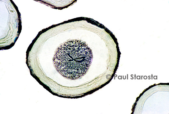 Ovocyte d'ascaris (Ascaris lumbricoides)